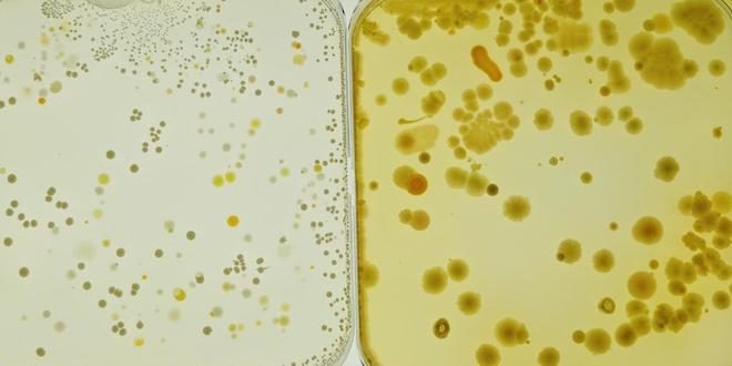 microbia growing in lab dishes